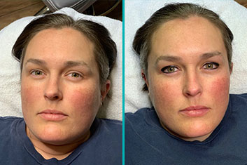 Permanent Makeup _ Eyeliner